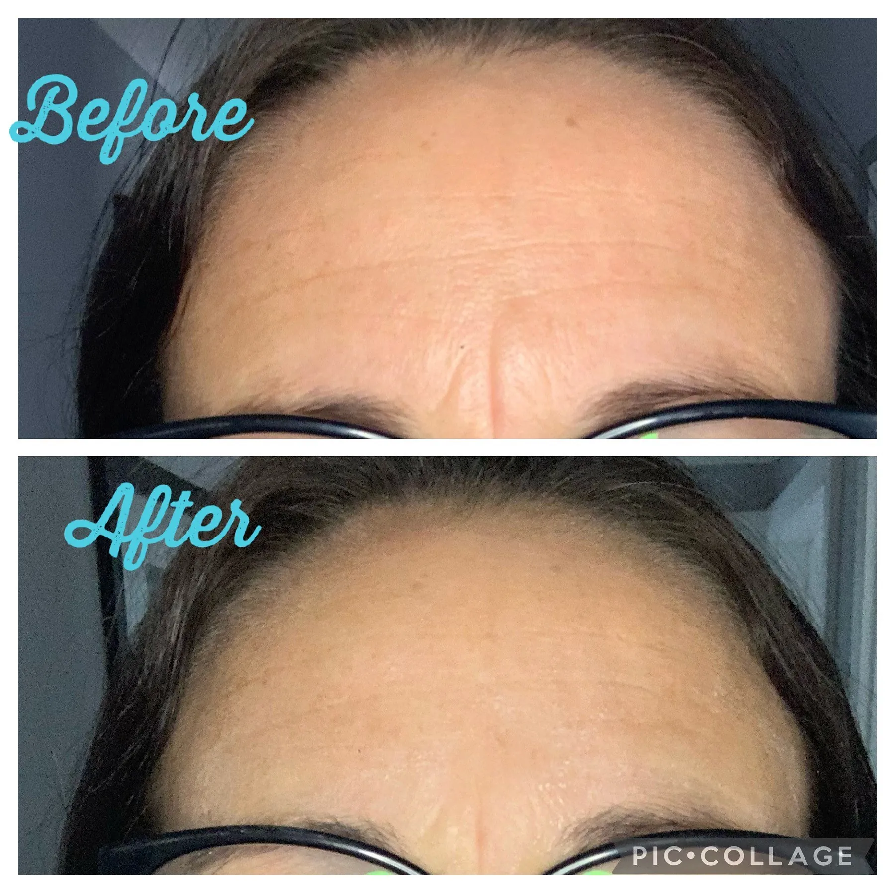 Instantly Ageless